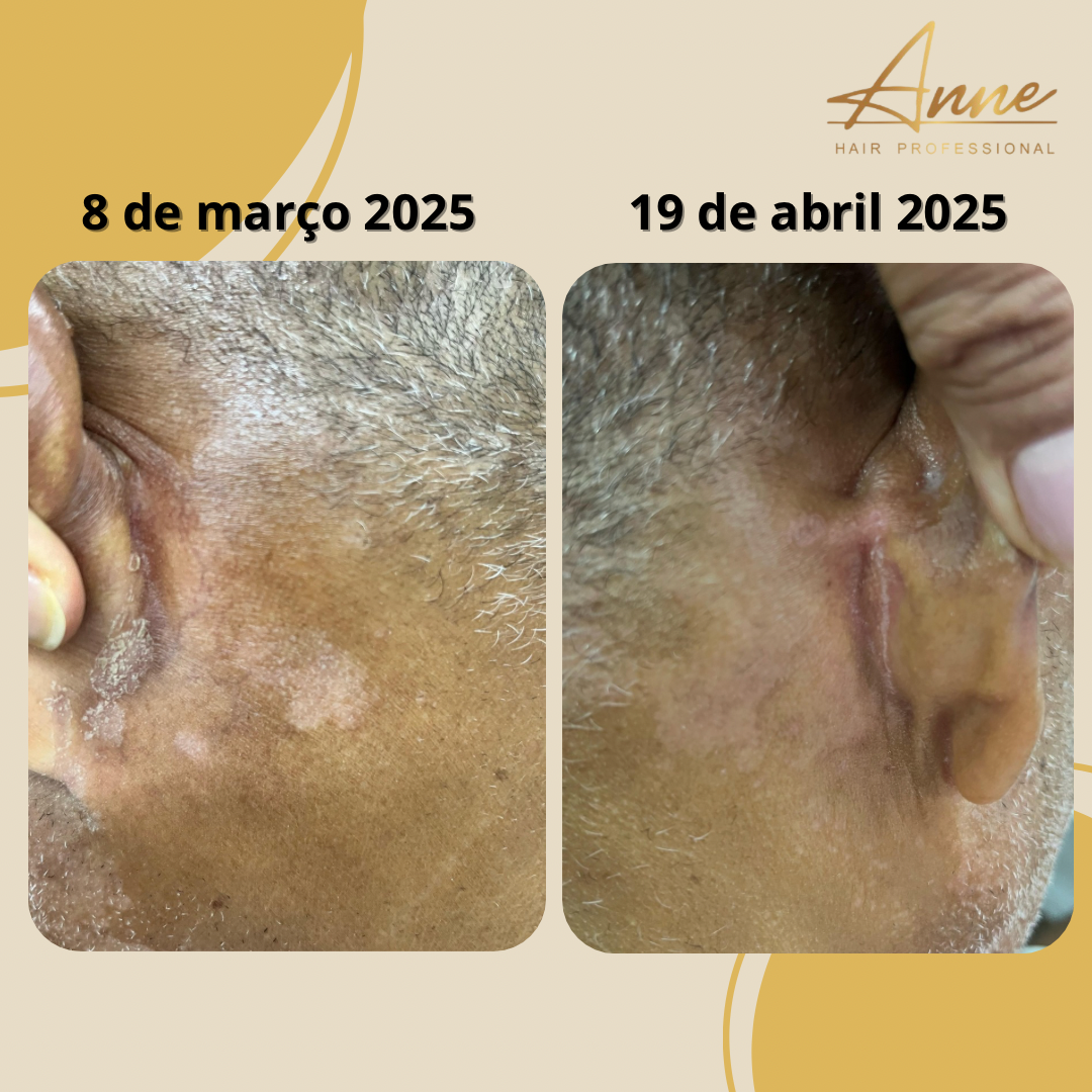 BLEND DE ÓLEOS- DERMATITE - Imagem 4